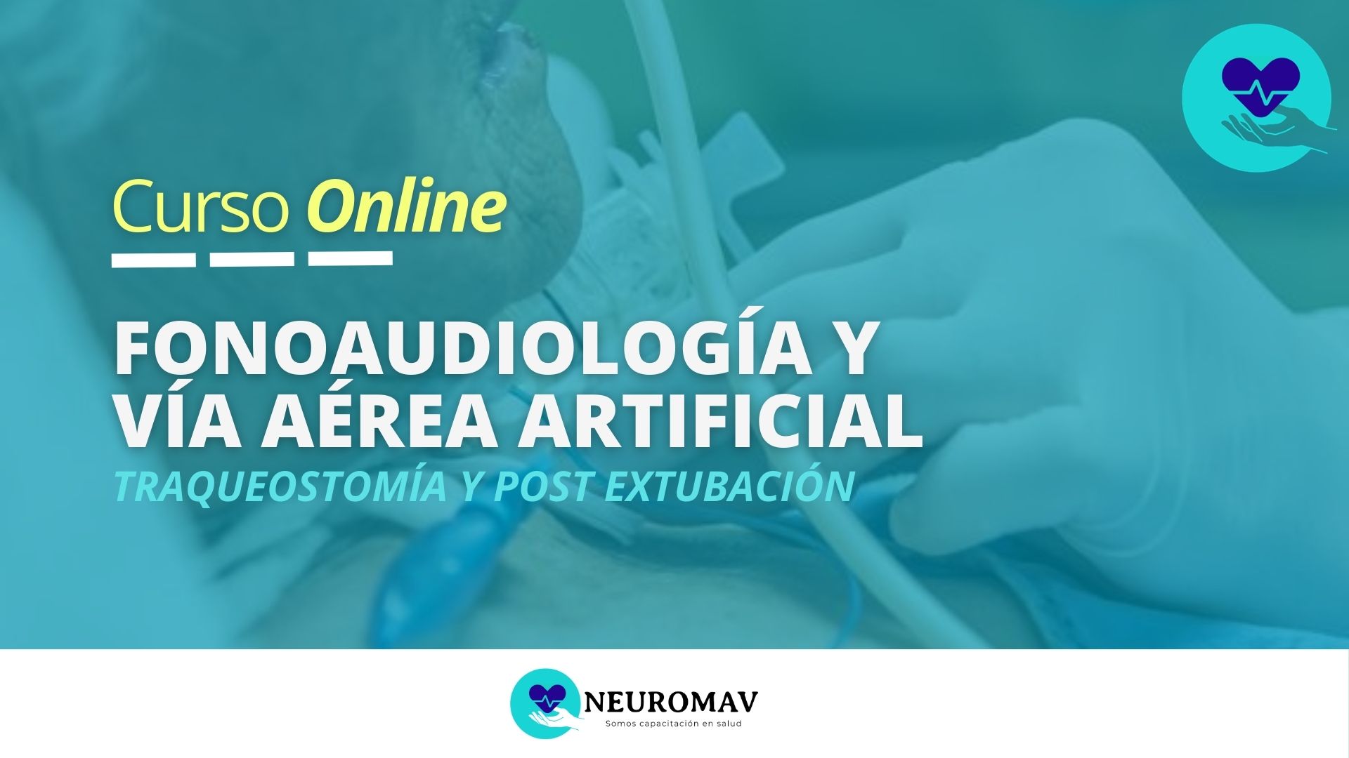 Fonoaudiología y vía aérea artificial: Traqueostomía y post extubación